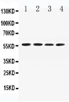 AGT / Angiotensinogen Antibody