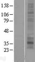 MMD2 Protein (Over-Expression Lysate Myc-DDK (Flag))