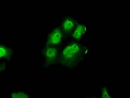 Monoclonal Mouse anti-Human ERCC1 Antibody (clone OTI2E11, IHC, IF, WB)
