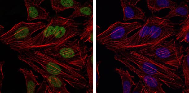 Monoclonal Mouse anti-Human BMI1 / PCGF4 Antibody (clone 3E3, IHC, IF, WB)