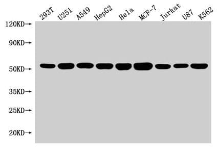 Polyclonal Rabbit anti-Human SLC25A24 / APC1 Antibody (IHC, IF, WB)