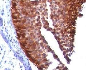 KRT17 / CK17 / Cytokeratin 17 Antibody (clone KRT17/778, Ready-to-Use)