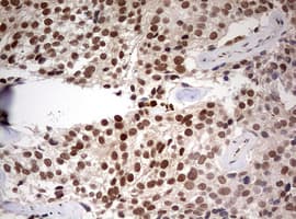 Monoclonal Mouse anti-Human TRIM24 / TIF1 Antibody (clone OTI2D9, aa706-1016, IHC, WB)
