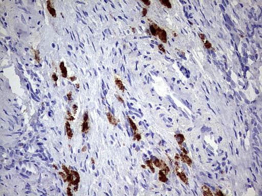 GBA / Glucosidase Beta Acid Antibody (aa40-315, clone UMAB171, Carrier-free)