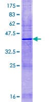 Human HSD11B1L Protein (Recombinant GST)