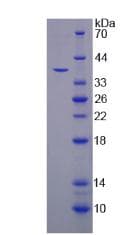 Human TPP1 / CLN2 Protein (Recombinant His-S)