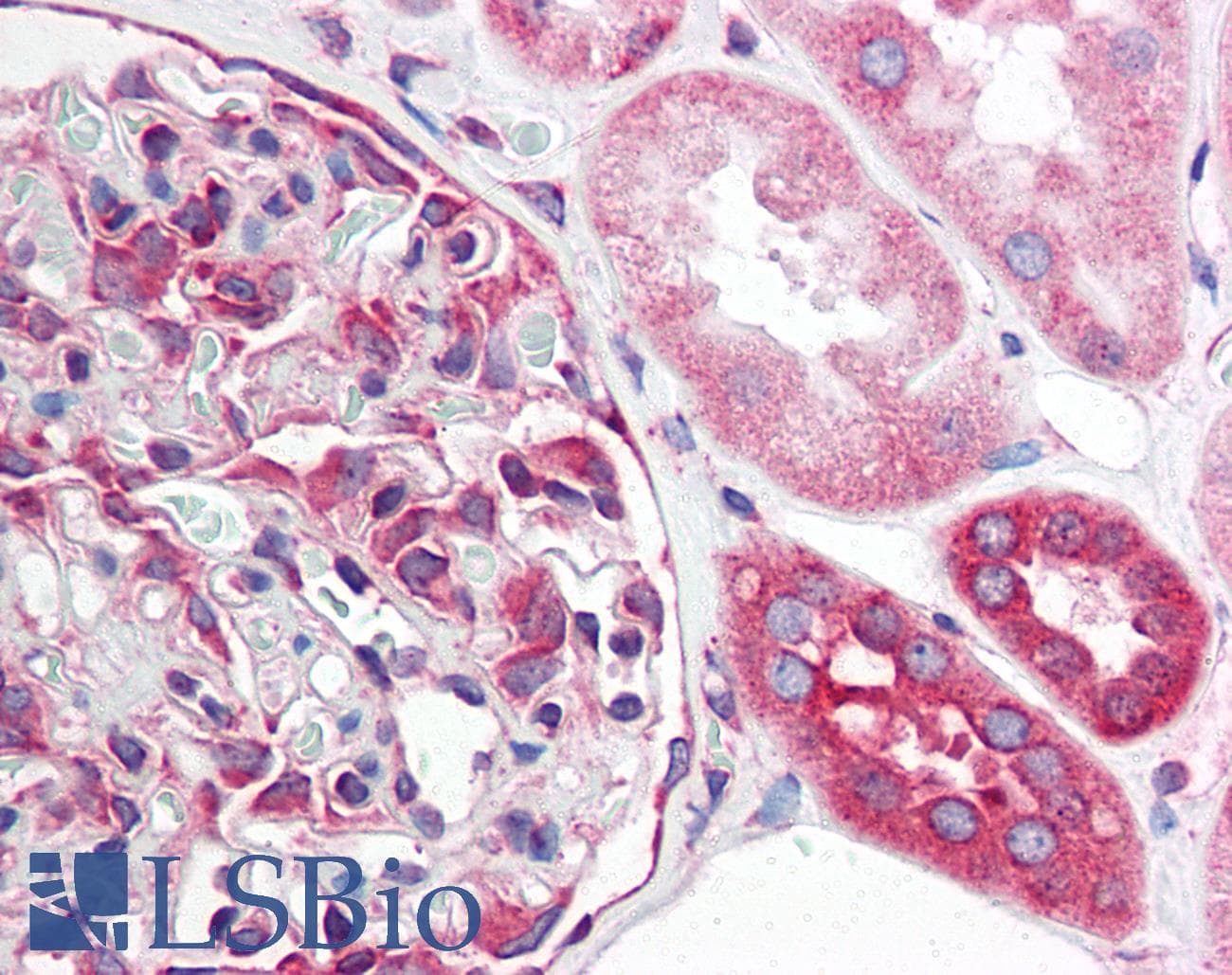 IHC-plus™ Polyclonal Rabbit anti-Human TNFRSF10A / DR4 Antibody (IHC, IF, WB)