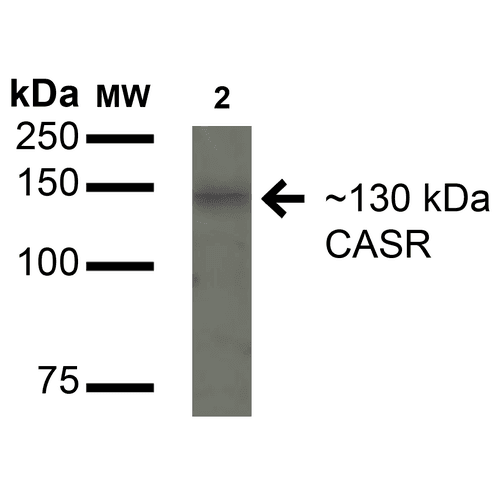 CASR/Calcium Sensing Receptor Antibody (Atto 594)