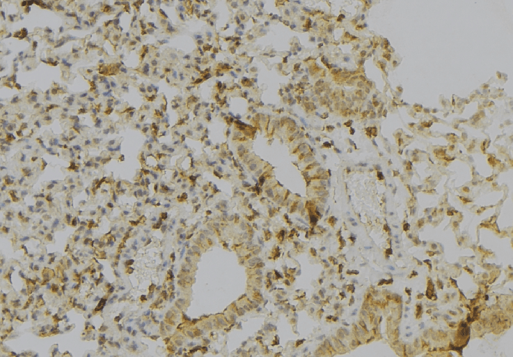 HLA-A Antibody