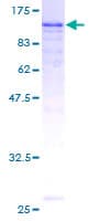 Human EPLIN Protein (Recombinant GST)