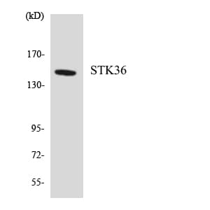 IHC-plus™ STK36 Antibody (aa373-422)