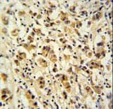 Polyclonal Rabbit anti-Human DDX49 Antibody (aa385-413, IHC, WB)