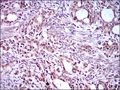 EKLF / KLF1 Antibody (aa208-362, clone 1B6A3)