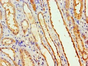 MTMR14 Antibody (aa1-280)