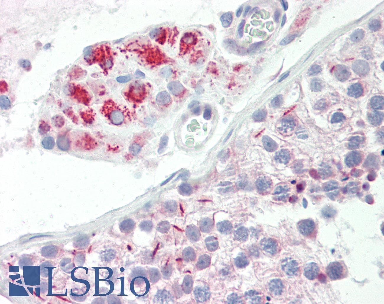 IHC-plus™ SURF1 Antibody (aa171-220)