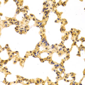 IPO5 / RANBP5 Antibody