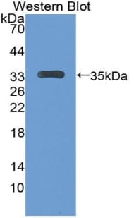 LTBP2 Antibody (aa522-814)