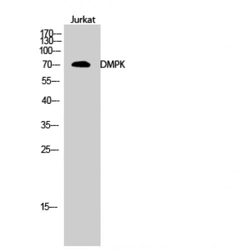 DMPK / DM Antibody (30-110 aa, N-terminal)