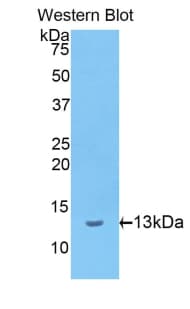 IVL / Involucrin Antibody (aa461-551)