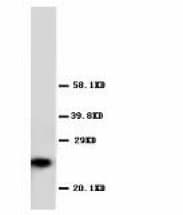 GSTP1 / GST Pi Antibody (aa197-210)