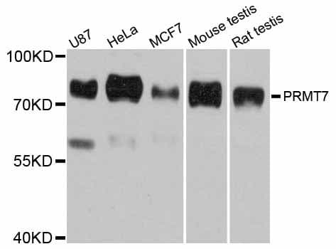 Polyclonal Rabbit anti-Human PRMT7 Antibody (WB)