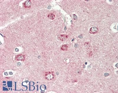 IHC-plus™ DKK3 Antibody
