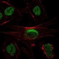 SIRT1 / Sirtuin 1 Antibody (clone 1F3)