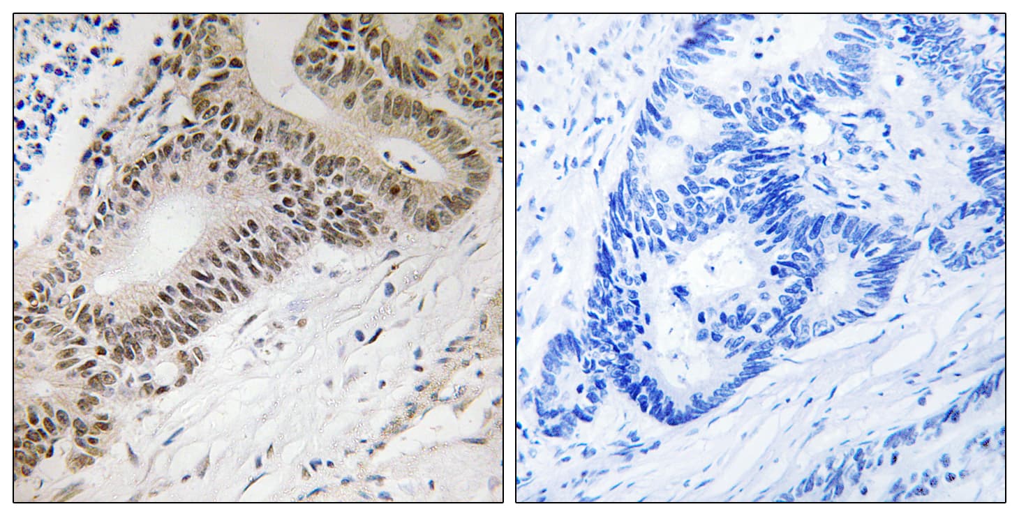 FOXO3 / FOXO3A Antibody (aa281-330)