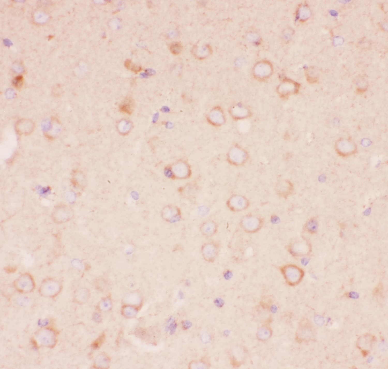 Tuberin / TSC2 Antibody (aa1611-1807)