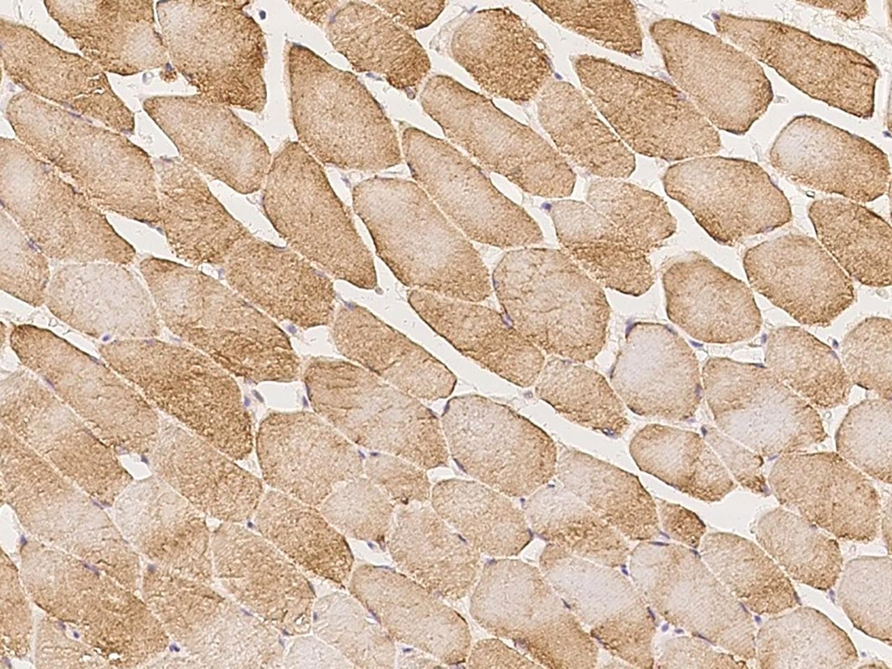 Polyclonal Rabbit anti-Human RAD9B Antibody (IHC)
