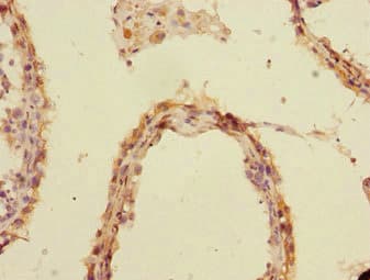 UBE2Z / USE1 Antibody