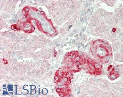 IHC-plus™ Nectin-1 / PVRL1 Antibody