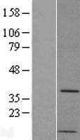 PP2Ac / PPP2CA Protein (Over-Expression Lysate Myc-DDK (Flag))