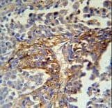 Polyclonal Rabbit anti-Human ARMC5 Antibody (aa599-628, IHC, WB)