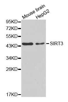 IHC-plus™ Polyclonal Rabbit anti-Human SIRT3 / Sirtuin 3 Antibody (IHC, WB)