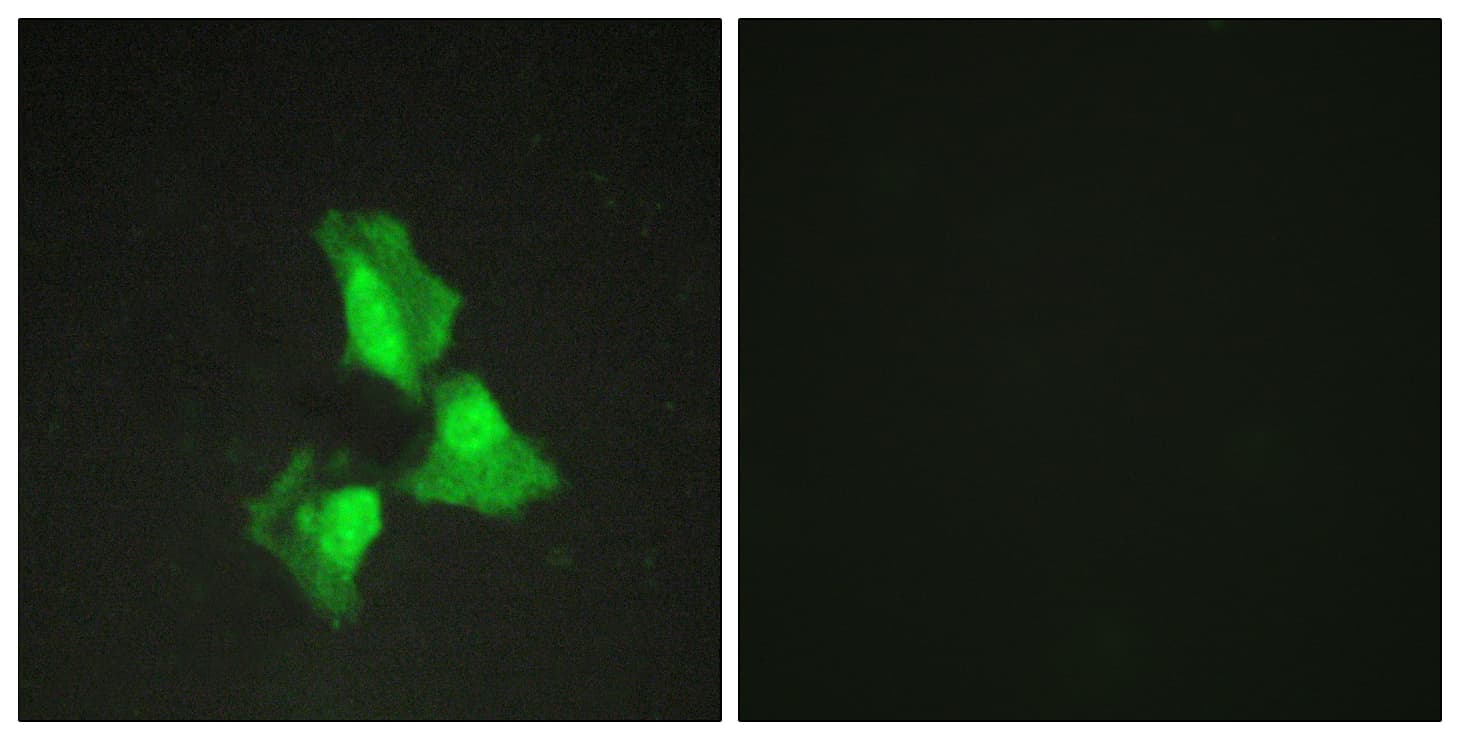 Polyclonal Rabbit anti-Human TNFAIP3 / A20 Antibody (aa321-370, IF, WB)