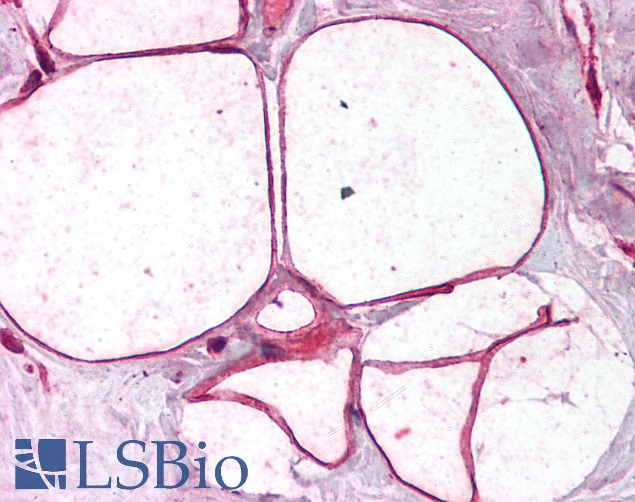 IHC-plus™ CAV3 / Caveolin 3 Antibody (aa19-41)