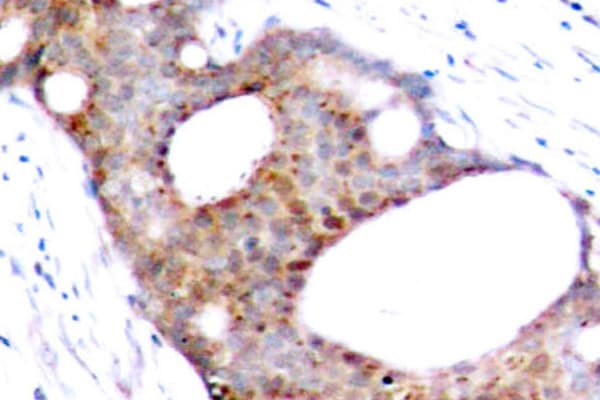 Polyclonal Rabbit anti-Human GSK3A / GSK3 Alpha Antibody (phospho-Ser21, IHC, WB)