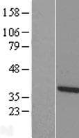 TTC1 Protein (Over-Expression Lysate Myc-DDK (Flag))