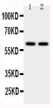 P450SCC / CYP11A1 Antibody (aa507-521)