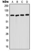 IHC-plus™ SMPD1 / Acid Sphingomyelinase Antibody (Internal)
