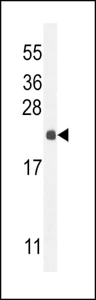 LOC729020 Antibody (aa 187-215, C-term)