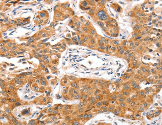 NUAK1 / ARK5 Antibody