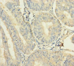 Polyclonal Rabbit anti-Human C12orf49 Antibody (aa34-205)