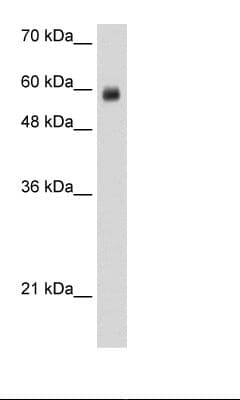 RCOR1 / COREST Antibody (N-Terminus)