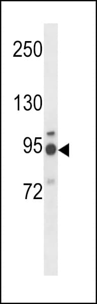 Polyclonal Rabbit anti-Human GNT-V / MGAT5 Antibody (aa652-680, WB)