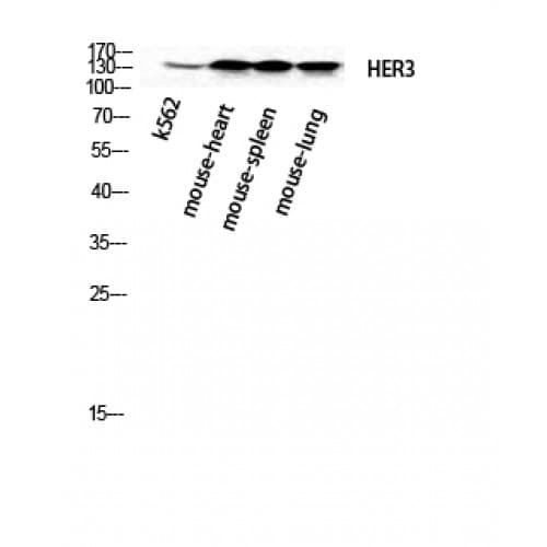 Polyclonal Rabbit anti-Human ERBB3 / HER3 Antibody (1-80 aa, N-terminal, IHC, WB)