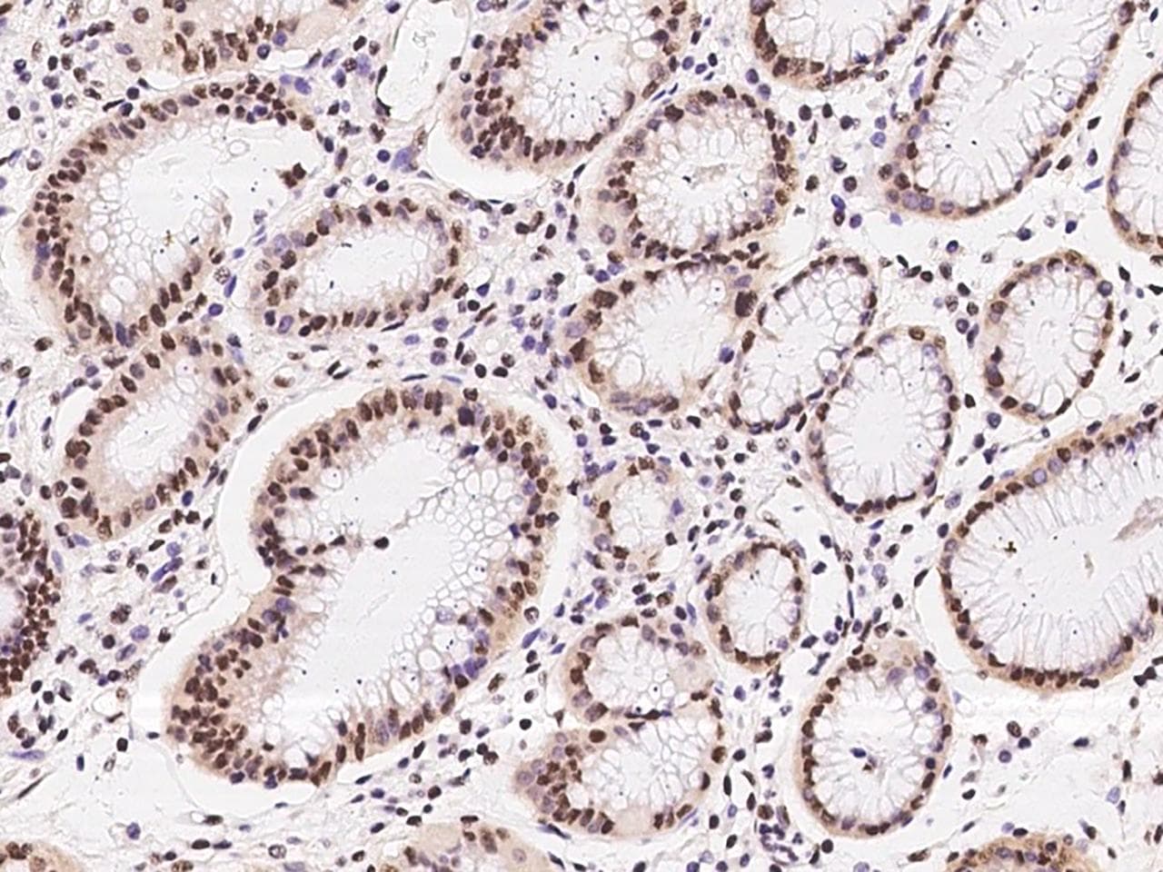 Polyclonal Rabbit anti-Human HDGFRP2 Antibody (IHC, IF)