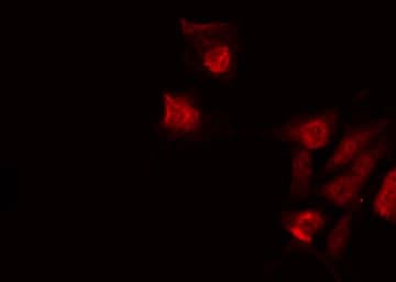 CASP6 / Caspase 6 Antibody (Cleaved Asp179)