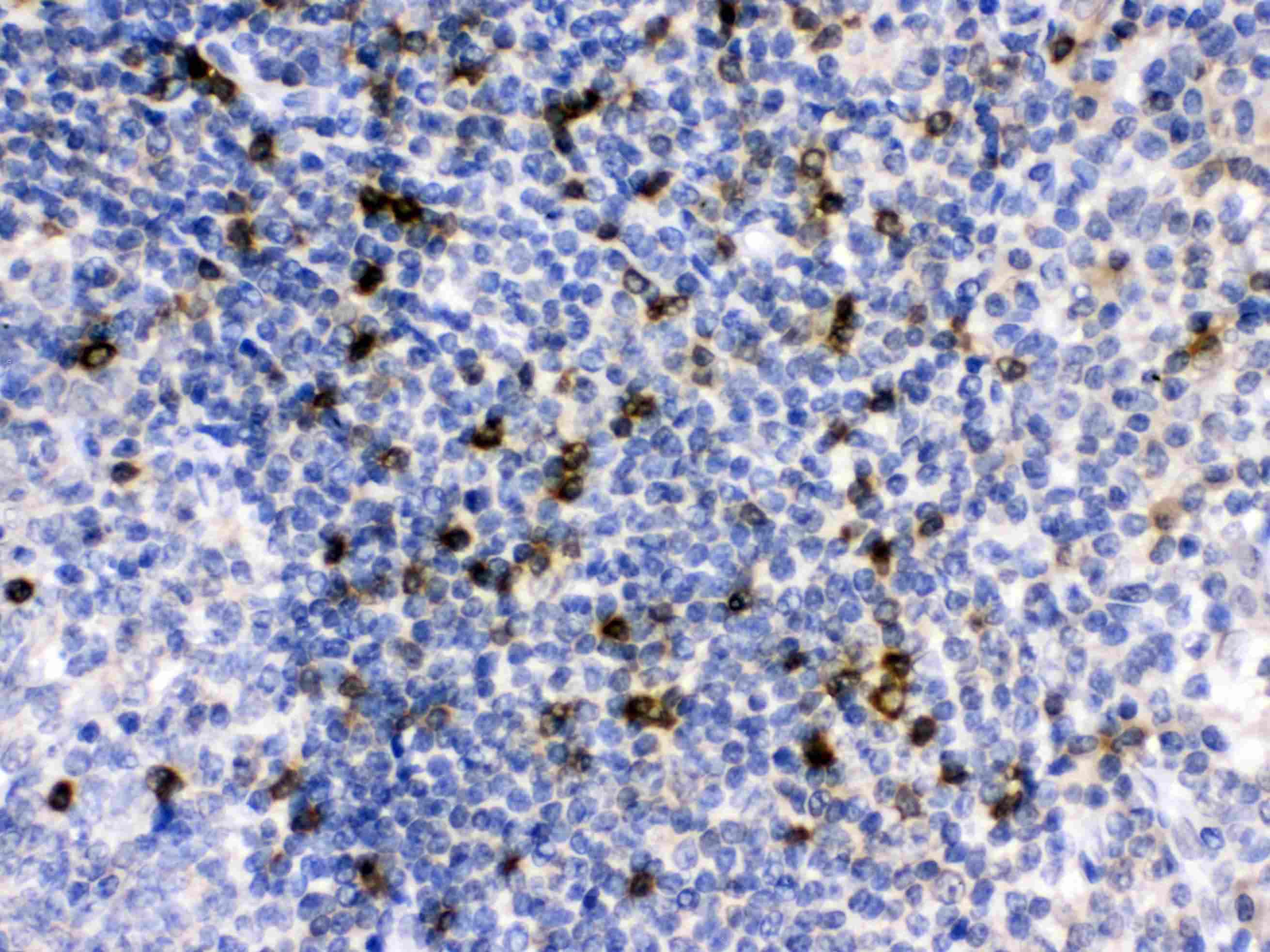 APOBEC3G / CEM15 Antibody